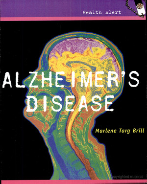 Alzheimer's Disease Alzheimer's Disease