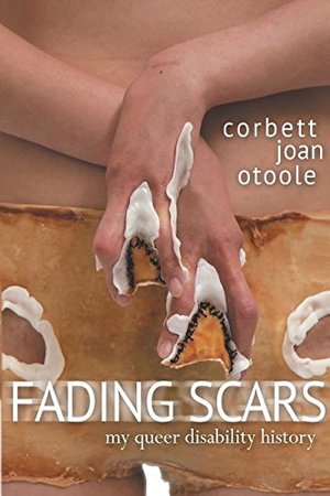 Fading Scars: My Queer Disability History Fading Scars: My Queer Disability History