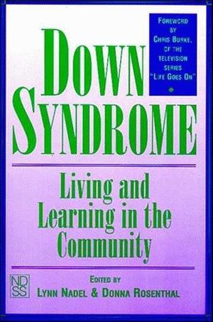 Down Syndrome Down Syndrome