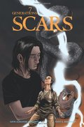 Scars Scars